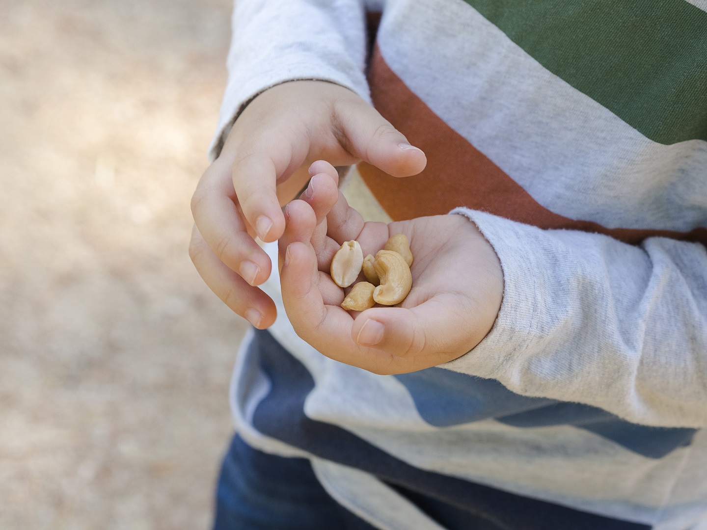 Nut Allergies, Symptoms and Treatments